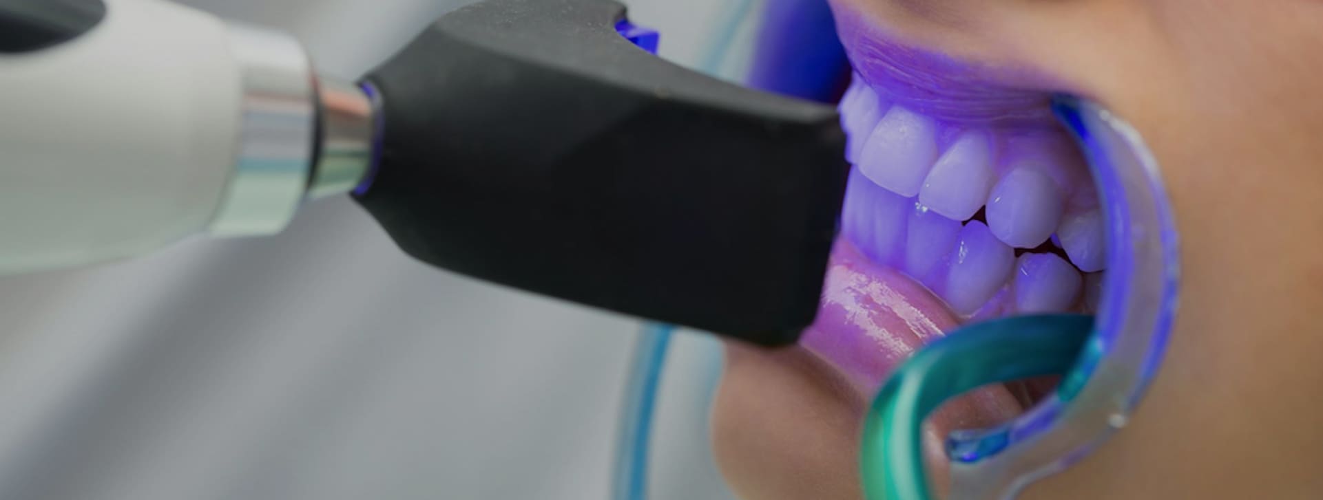 Dr. Lucas Portilho - www.drlucasportilho.com.br - Dentista - Goiânia - Postagem do Blog - 002