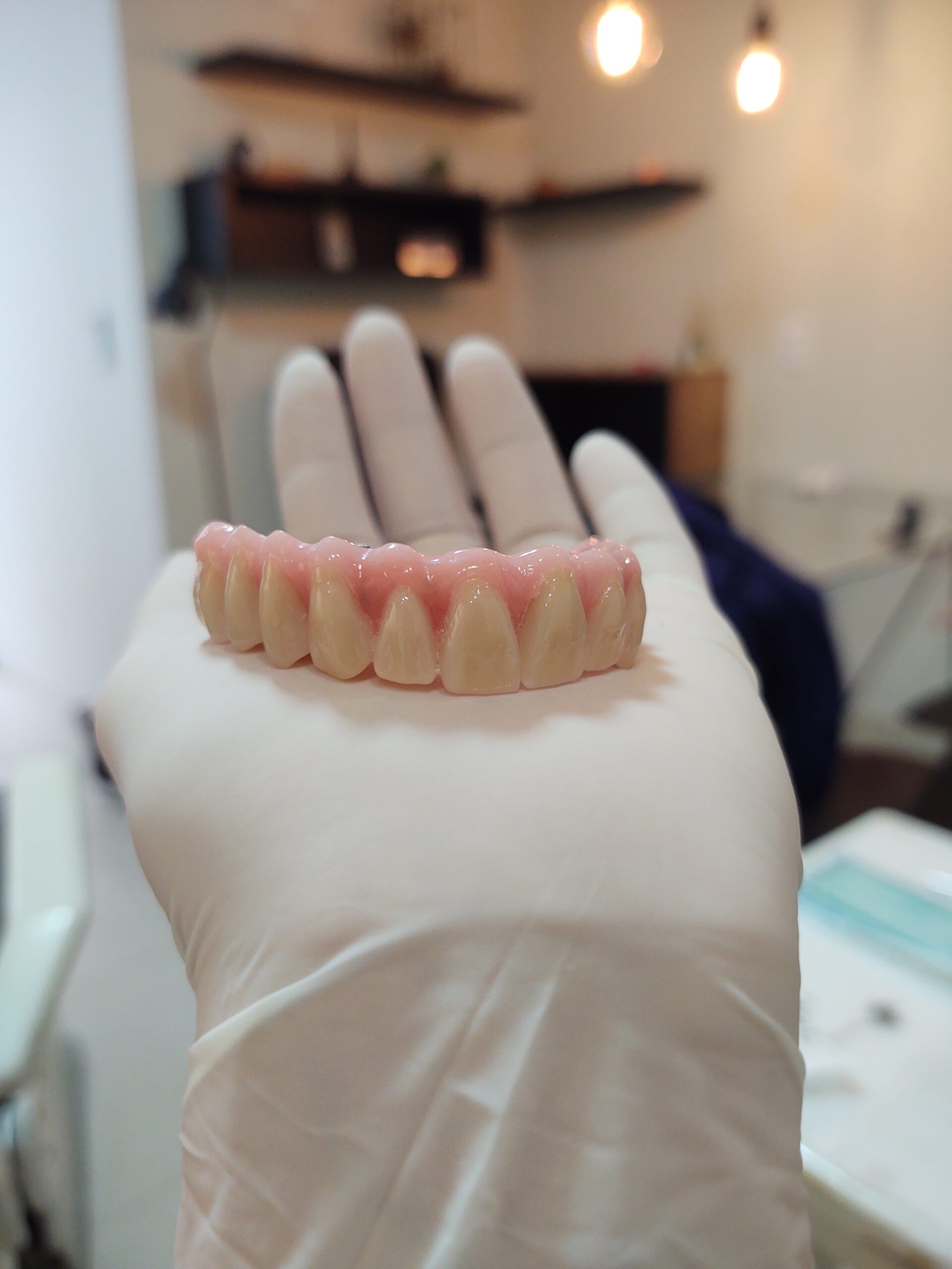 Implante dentário Goiânia, dentista especialista em implante Goiânia, clínica de implante Jardim América, reabilitação oral Goiânia, Dr. Lucas Portilho.